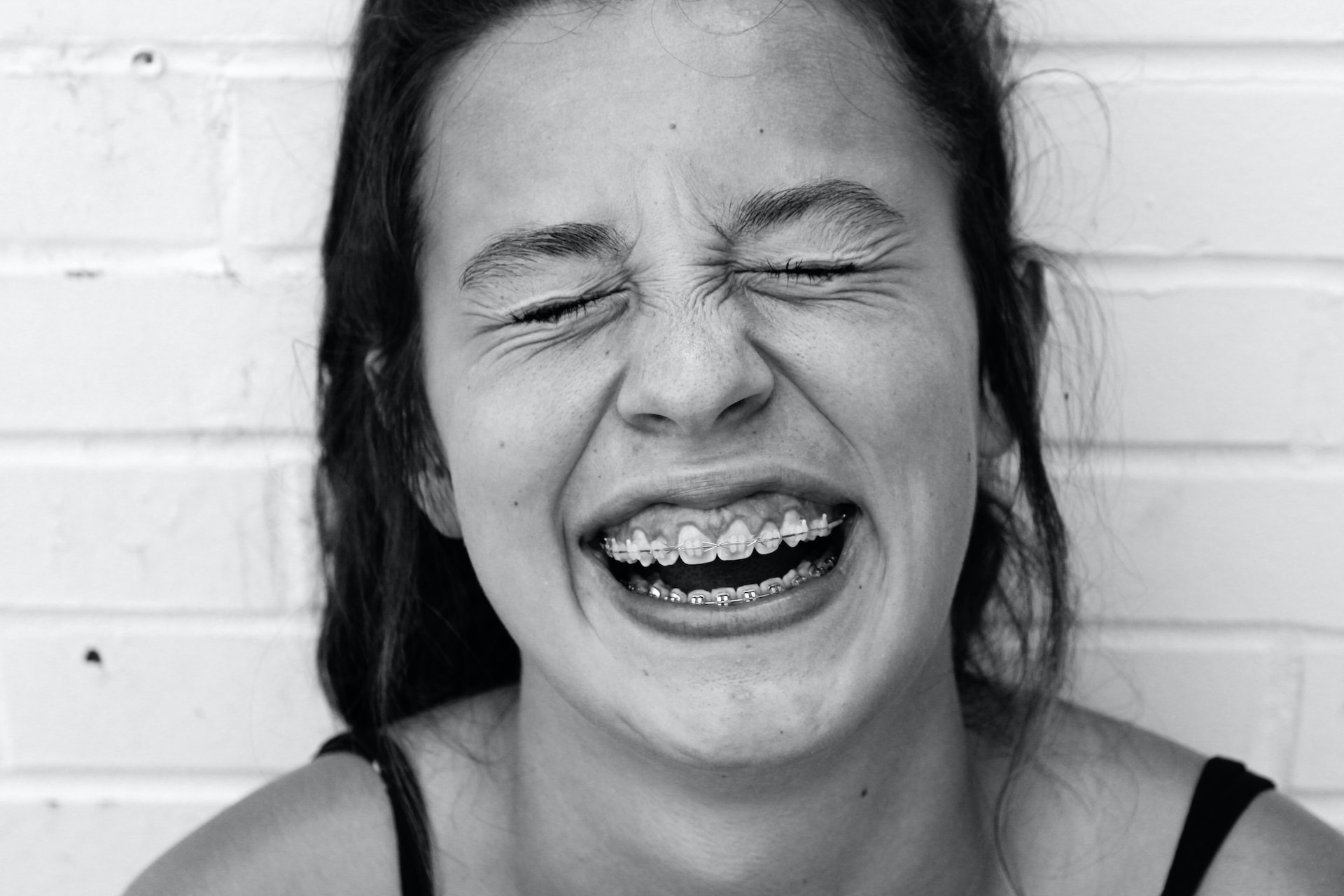 Orthodontist braces for adults Clearwater FL