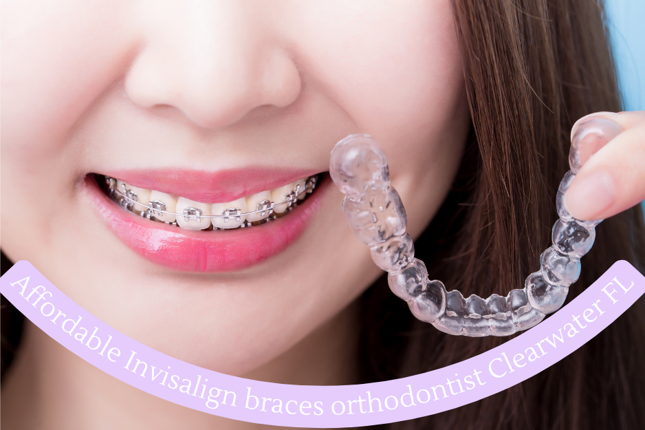 Affordable Invisalign braces orthodontist Clearwater FL